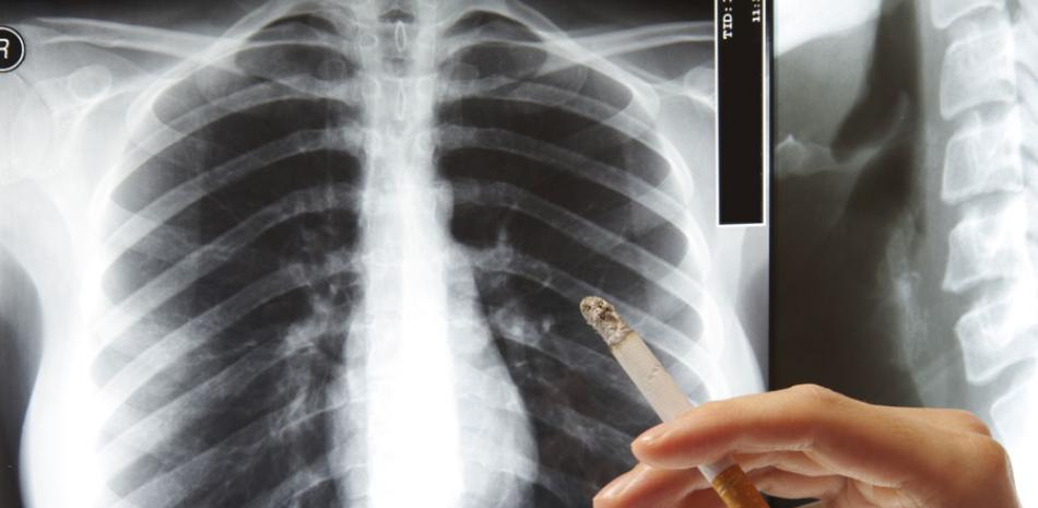 La cifra de los fallecimientos por minuto es dada por la OMS, que también advierte que “no hay ningún nivel de exposición al humo del tabaco sin riesgo”. ISTOCK/LD