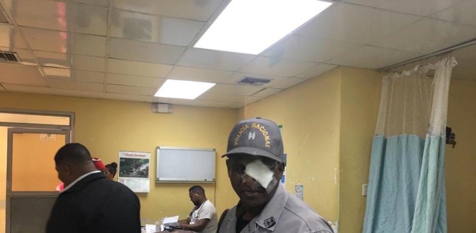 Oficial herido en la cara por reclusos. Foto: Benny Rodríguez.