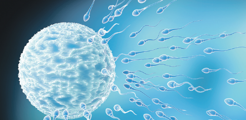 La congelación de esperma consiste en tomar varias muestras de semen con la finalidad de mantener varios viales para su posterior uso en la reproducción asistida.