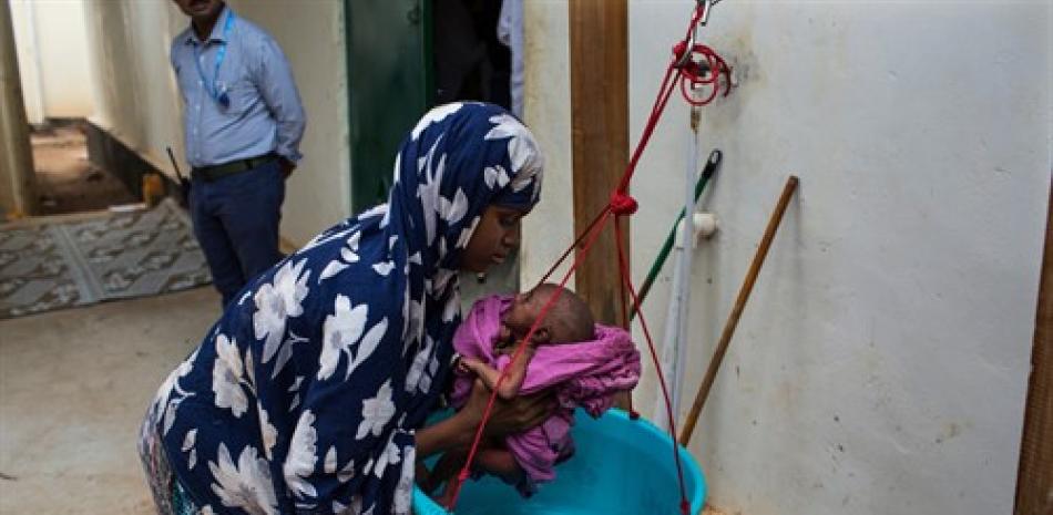 Un niño con desnutrición en Somalia. Fuente: Europa Press