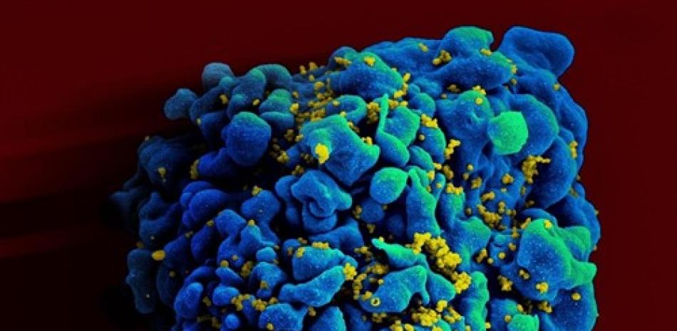 Escaneo electromicrográfico de una célula T infectada con VIH. Europa Press