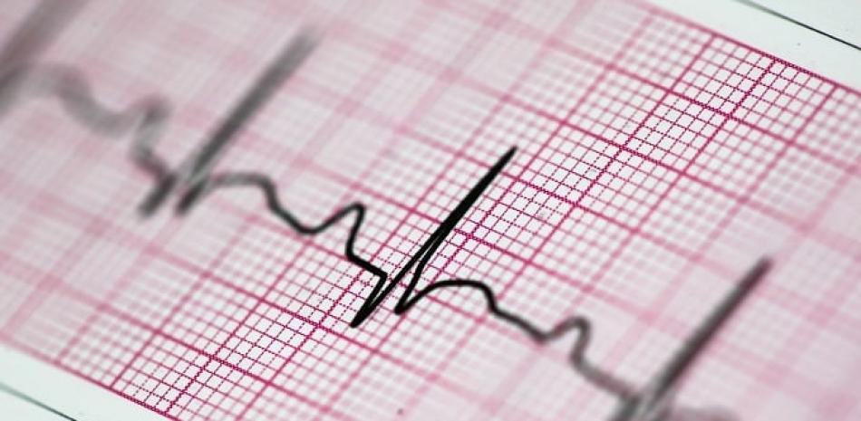 El electrocardiograma es el registro o la representación gráfica de la actividad eléctrica del corazón. ISTOCK