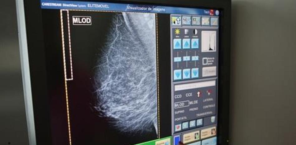 Mamografía - EUROPA PRESS - Archivo