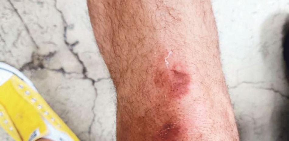 Los médicos han sufrido atropellos constantes.