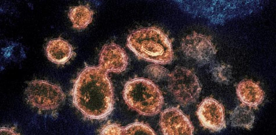 Esta imagen de microscopio eletrónico provista por el Instituto Nacional de Alergia y enfermedades infecciosas muestra partículas del virus SARS-CoV-2 que causan COVID-19 aisladas de un enfermo en EEUU.

Foto: NIAID-RML/AP