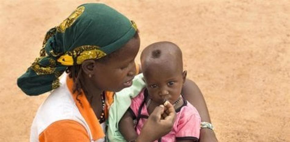Una madre da de comer a su hijo desnutrido en Burkina Faso.

Foto: UNICEF/JADWIGA FIGULA/EP