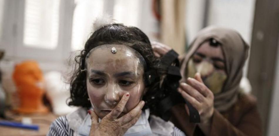 Maram y su madre Izdihar al-Amawi sufrieron graves quemaduras. Ahora usan una de las máscaras de plástico diseñadas en impresoras 3D. / MOHAMMED ABED. El Espectador.