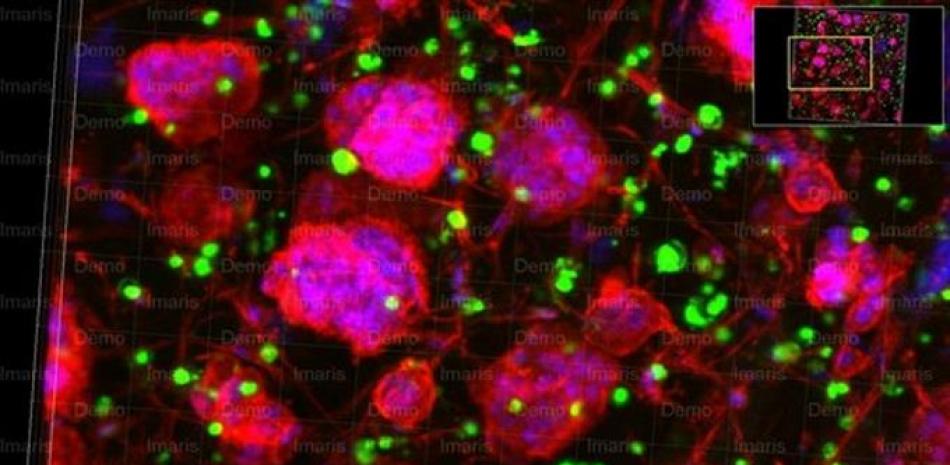 Esferoides cancerosos elaborados a partir de cultivos triples que incluyen células de cáncer de ovario, células endoteliales y células madre mesenquimales que crecen dentro del material de coensamblaje péptido-proteína.

Foto: ÁLVARO MATA/EP