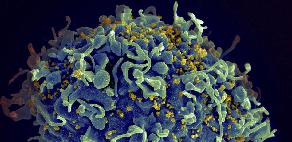 En esta imagen de archivo, distribuida por los Institutos Nacionales de Salud de Estados Unidos, se muestra una célula T humana (en azul) atacada por el VIH (en amarillo), el virus que causa el sida, al microscopio.

Foto: Seth Pincus, Elizabeth Fischer, Austin Athman/Instituto Nacional de Alergias y Enfermedades Infecciosas/NIH vía AP