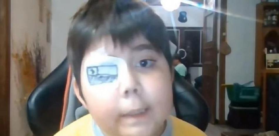 El youtuber Tommiii 11 murió el lunes a causa de un cáncer cerebral.