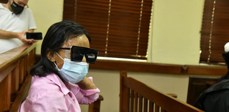 Yocairi Amarante, que el 25 de septiembre de 2020 fue atacada con ácido del diablo. 

Foto: José Alberto Maldonado/ Listín Diario.