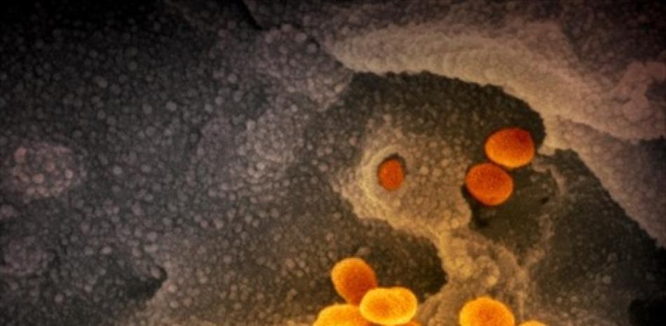 Esta imagen de microscopio electrónico de barrido muestra el SARS-CoV-2 (naranja), el virus que causa la COVID-19, aislado de un paciente en EE.UU. El virus emerge de la superficie de las células (gris) cultivadas en el laboratorio.