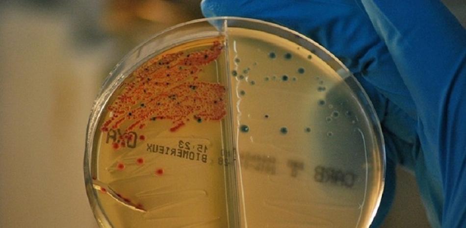 Bacterias resistentes a los antibióticos aisladas en un laboratorio. Foto de ARCHIVO