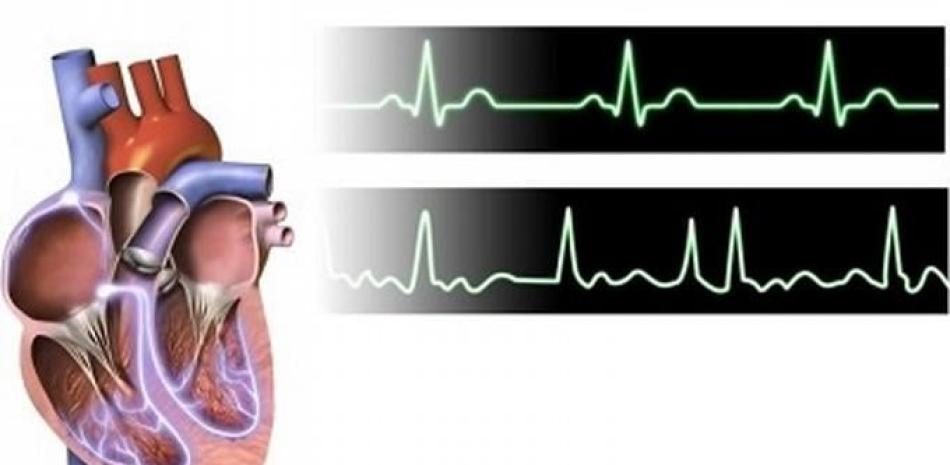 Corazón, electrocardiograma, cardiaco. Europa Press.