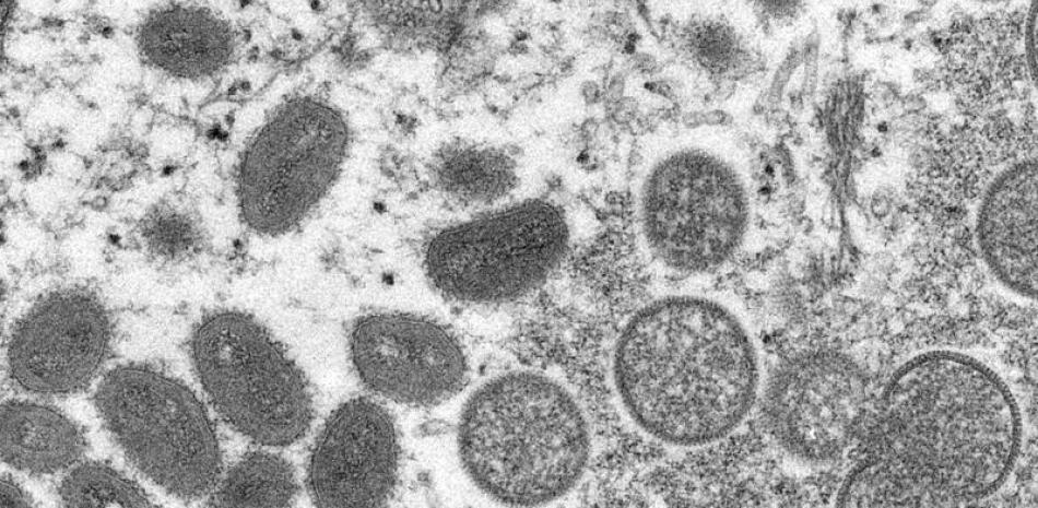 Esta imagen de un microscopio electrónico, proporcionada el miércoles 18 de mayo de 2022 por los Centros para el Control y la Prevención de Enfermedades (CDC, por sus siglas en inglés) de Estados Unidos, muestra viriones maduros de viruela símica, de forma ovalada (izquierda) y viriones inmaduros esféricos (derecha), obtenidos de una muestra de piel humana vinculada con un brote de 2003. (Cynthia S. Goldsmith, Russell Regner/CDC vía AP)