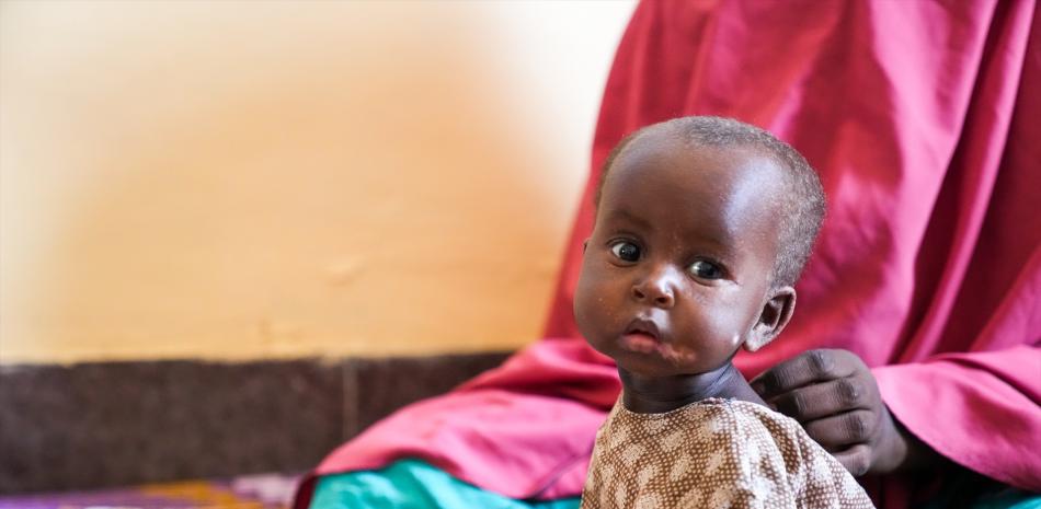 Archivo - Marwo, una niña de 10 meses sentada con su madre en el Banadir Hospital en Mogadishu, Somalia , donde entró con desnutrición severa - UNICEF/UN0644292/FAZEL - Archivo | EP
