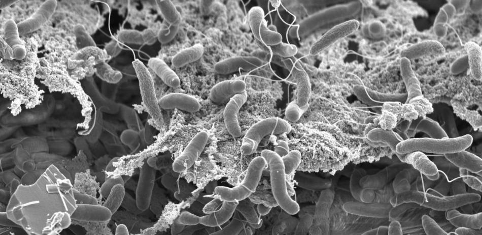 Vibrio cholerae.

Foto: G. KNOTT & M. BLOKESCH, EPFL