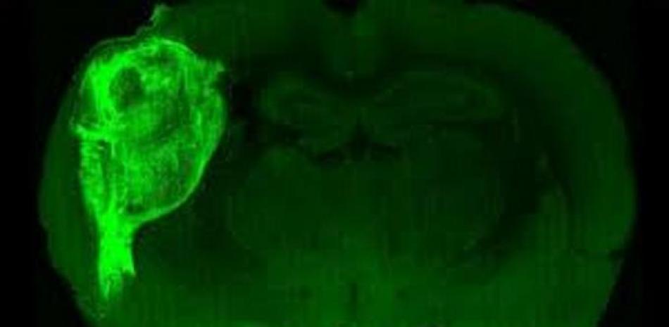 Un organoide humano trasplantado y marcado con una proteína fluorescente en una sección del cerebro de la rata.EFE/ Crédito: Universidad de Stanford.