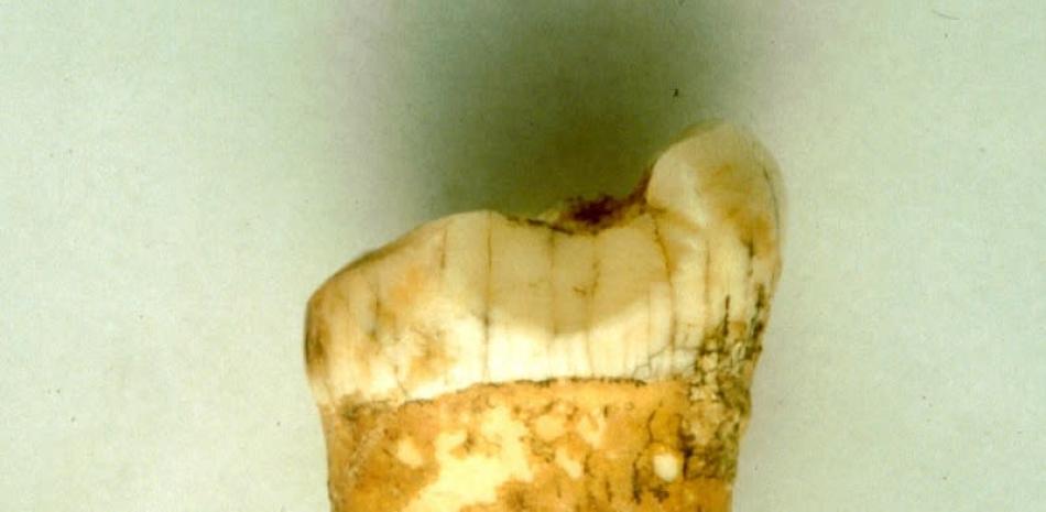 Molar del neandertal analizado en el estudio. Imagen facilitada por el CNRS, © Lourdes Montes.