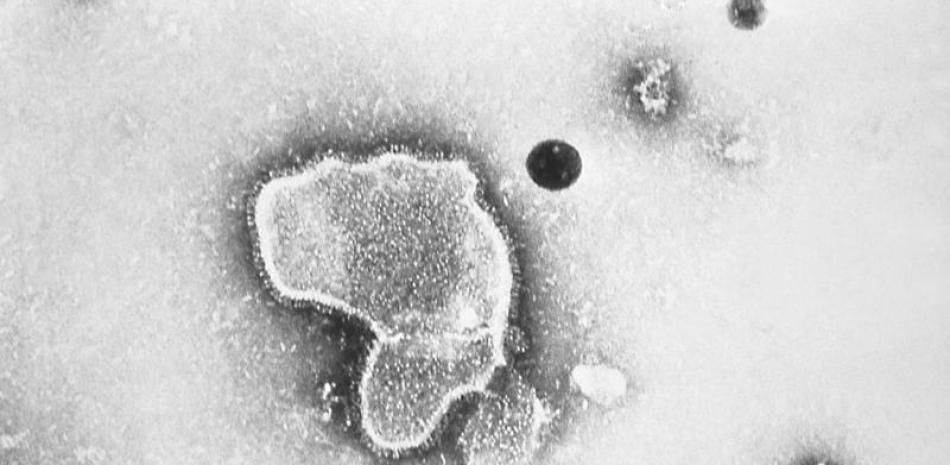 En esta imagen de 1981 cortesía de los Centros para el Control y la Prevención de Enfermedades de EEUU se ve una foto de un microscopio de electrones del virus respiratorio sincitial. (CDC via AP)
