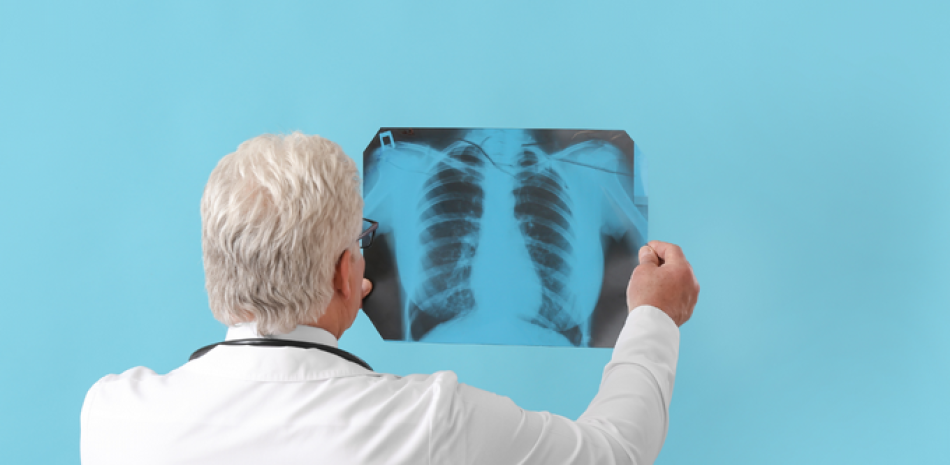 Médico con imagen de rayos X de los pulmones.