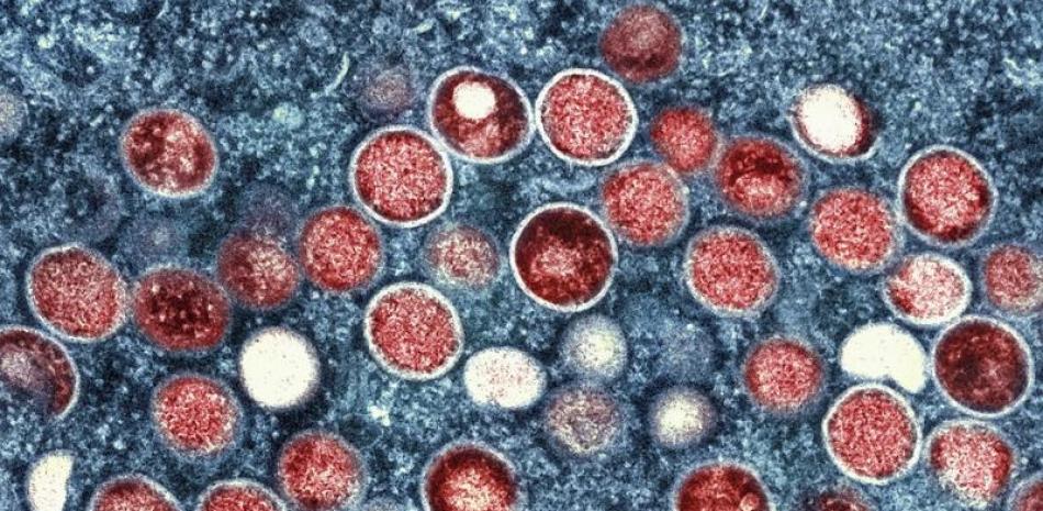 Esta imagen proporcionada por el Instituto Nacional de Alergias y Enfermedades Infecciosas de EEUU (NIAID) muestra una micrografía electrónica de partículas de viruela del simio (rojas), cultivadas en laboratorio. AP