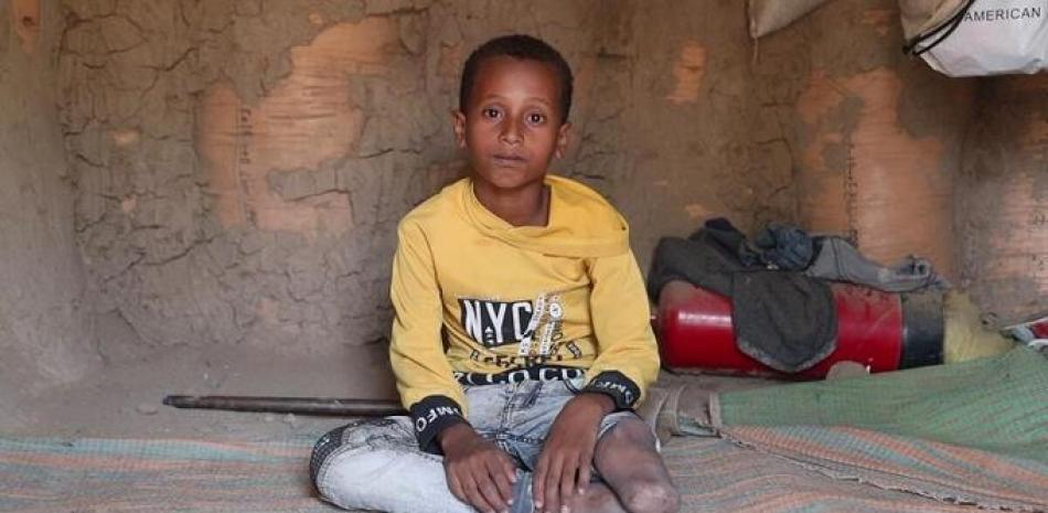 Zaid, un niño de nueve años que vive en un campo de desplazados cerac de Taiz, en Yemen. Foto: Europa Press