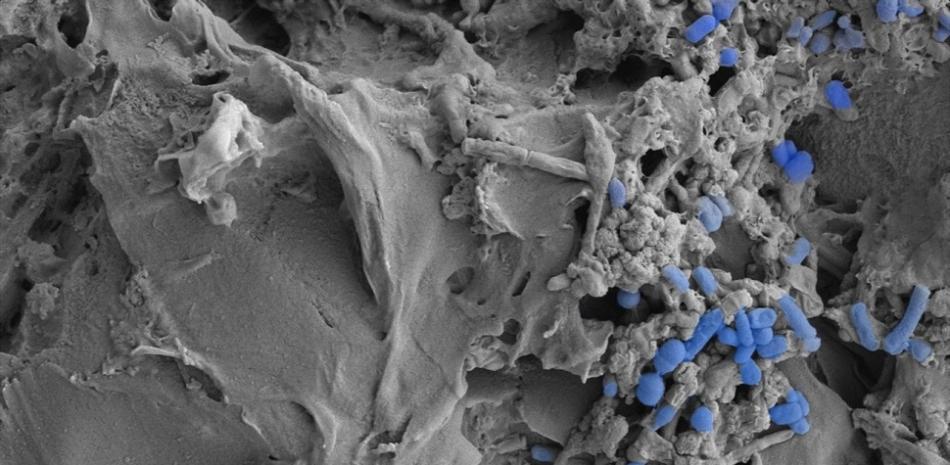 Imagen microscópica de microplásticos colonizados por la microbiota intestinal.  © CSIC