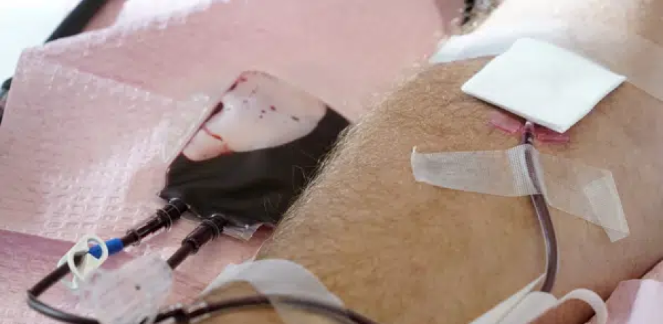Los tubos dirigen sangre de un donante a una bolsa en Davenport, Iowa, el viernes 11 de noviembre de 2022. EE. UU. AP,