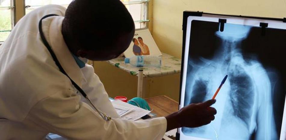 Un médico observa una imagen de rayos X. / Archivo