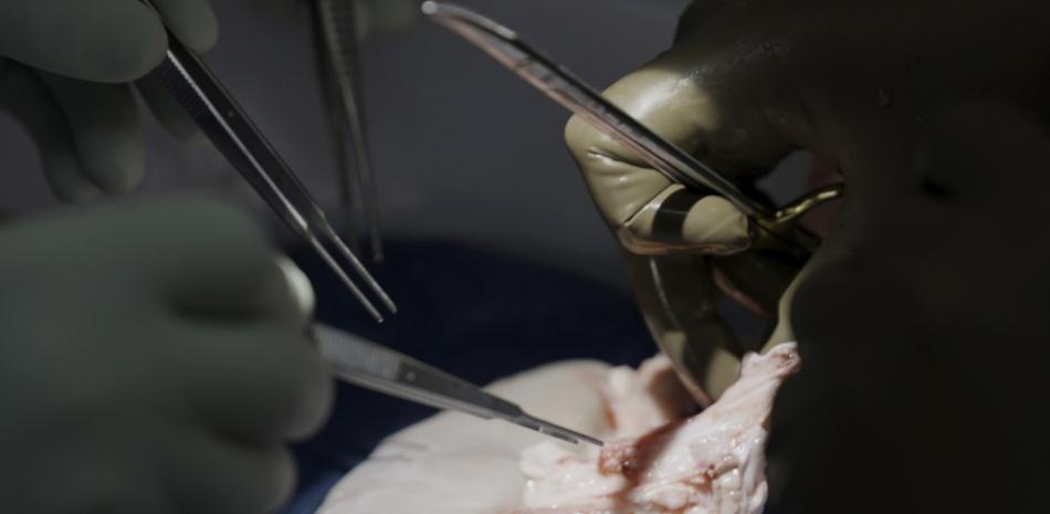 Cirujanos de Langone Health de la NYU se preparan para trasplantar un riñón de cerdo a un hombre