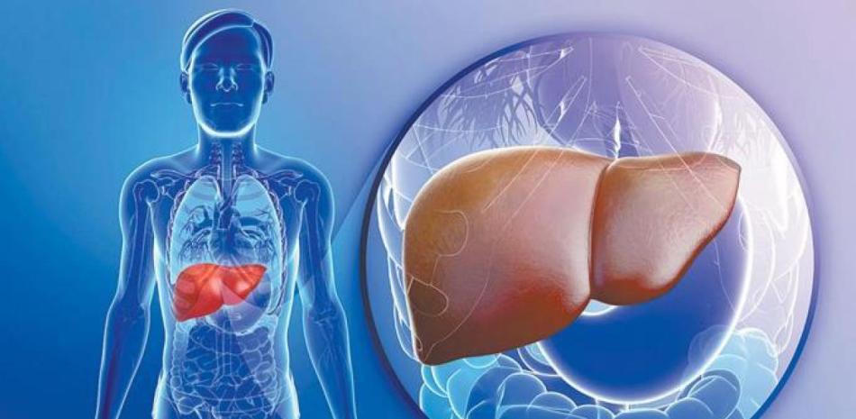 Experto advierte sobre el estigma social del cáncer de hígado: "Tradicionalmente se ha vinculado al alcoholismo"