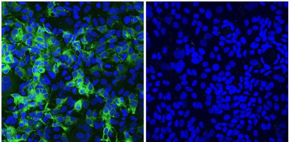 Imagen de las líneas celulares infectadas con el Virus de la hepatitis C marcado en verde (izquierda), y tras la curación de la infección (derecha).