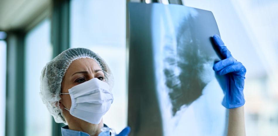 
        La intervención temprana es el mayor desafío en la atención de la fibrosis pulmonar idiopática
    