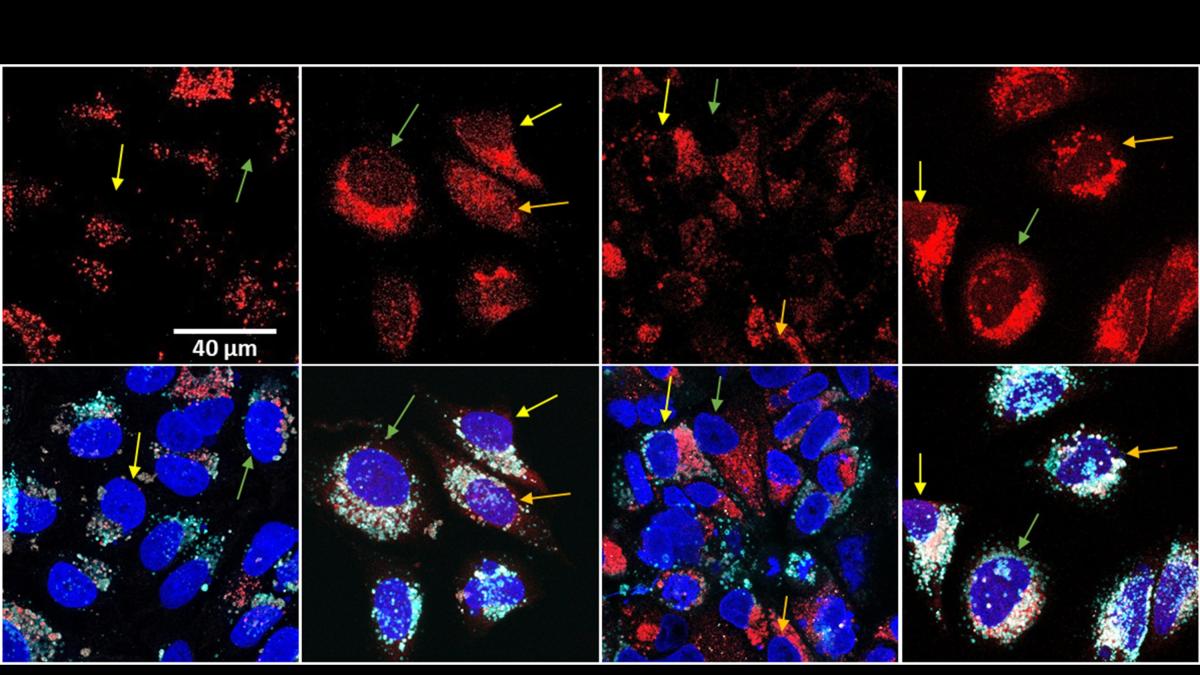 Nueva estrategia contra el cáncer logra mayor eficacia con menos quimioterapia