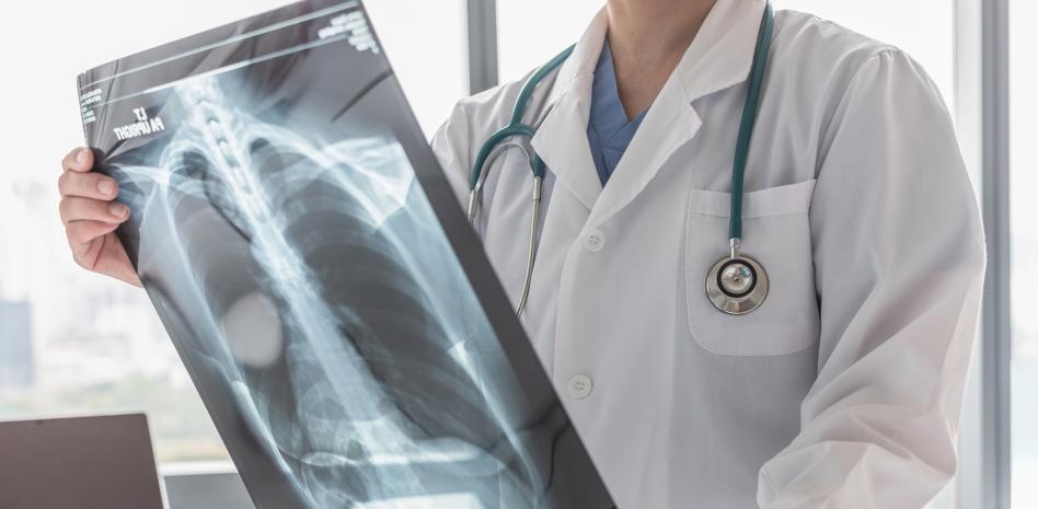 Piden fortalecer el diagnóstico temprano de la hipertensión arterial pulmonar