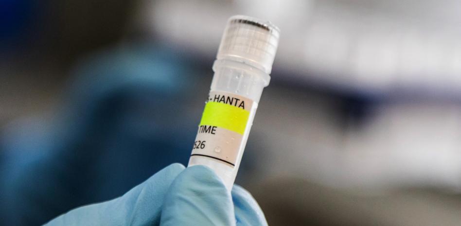 Hantavirus: 5 casos confirmados y otros 4 sospechosos, OMS investiga el origen en Cono Sur