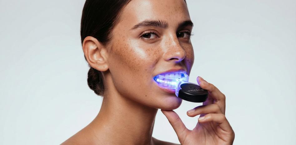 Lo que hay que saber del blanqueamiento dental en casa