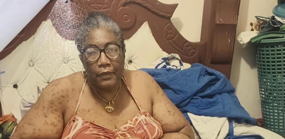 Ex-deportista solicita ayuda por complicaciones de salud
