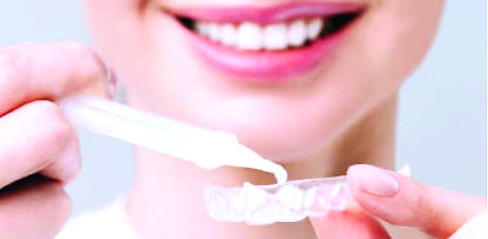 Las carillas dentales ¿Un lujo o una necesidad?