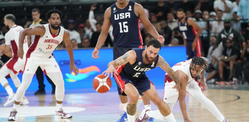 ¿Porqué perdió equipo dominicano ante Estados Unidos?