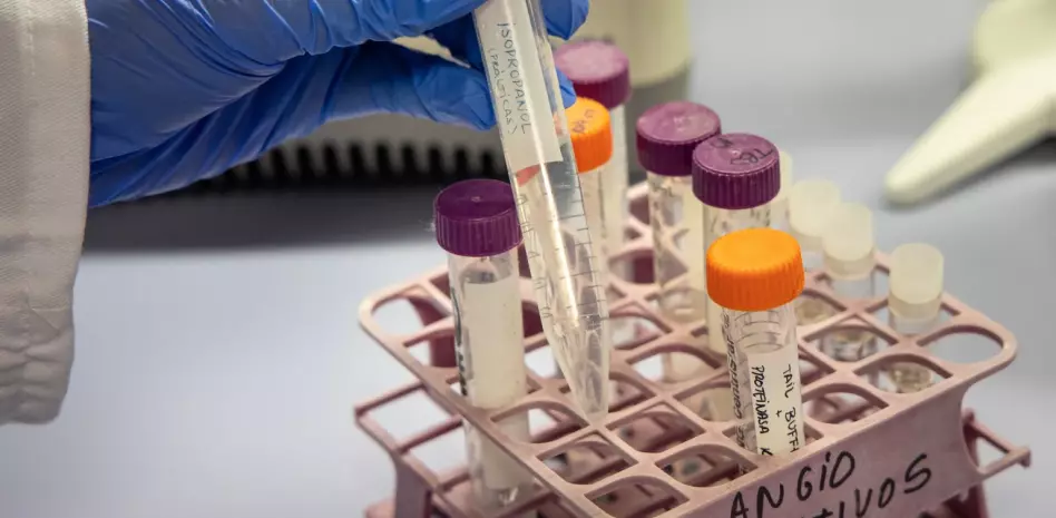 Científicos desarrollan terapia génica para prevenir el alzhéimer