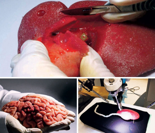 En las imágenes, réplicas impresas en tres dimensiones (3D) de un riñón usado durante una práctica de extirpación de tumor; un cerebro humano y un riñón y uréter utilizados para entrenar a residentes de hospitales.