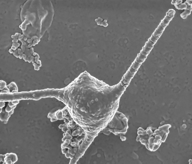 La imagen en un microscopio electrónico de barrido de un Prometheoarchaeum syntrophicum, un microbio que comienza como una pequeña esfera, para luego desarrollar largos tentáculos y liberar burbujas cubiertas de membrana con el paso de los meses. (Hiroyuki Imachi, Masaru K. Nobu y JAMS).