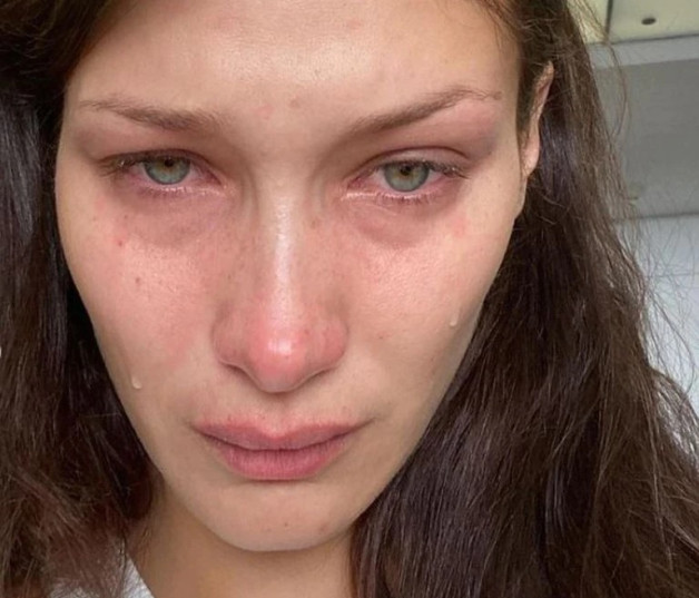 La supermodelo Bella Hadid, de 25 años, lució llorosa en las imágenes que compartió con sus seguidores en Instagram.