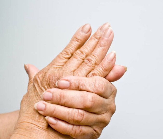 Una vida sedentaria causa músculos débiles y aumenta las probabilidades de artritis.