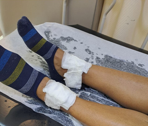 Fotografía muestras pies de estudiante de la Universidad Dominicana O&M afectada por explosión.