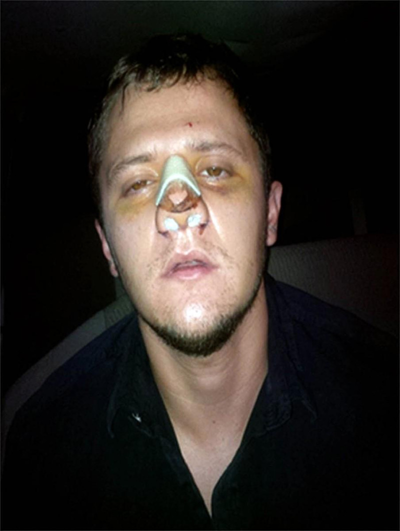 Fotografía difundida por la Secretaría de Gobernación de México de Rubén Oseguera González, alias "El Menchito", en Ciudad de México, el 23 de junio de 2015