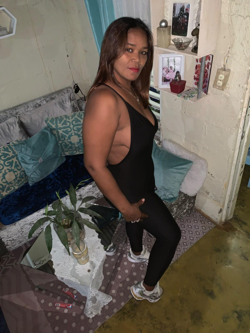 Marilenny Cuello, de 44 años está ingresada en el Hospital Doctor Darío Contreras, tras haber sufrido un impacto de bala.