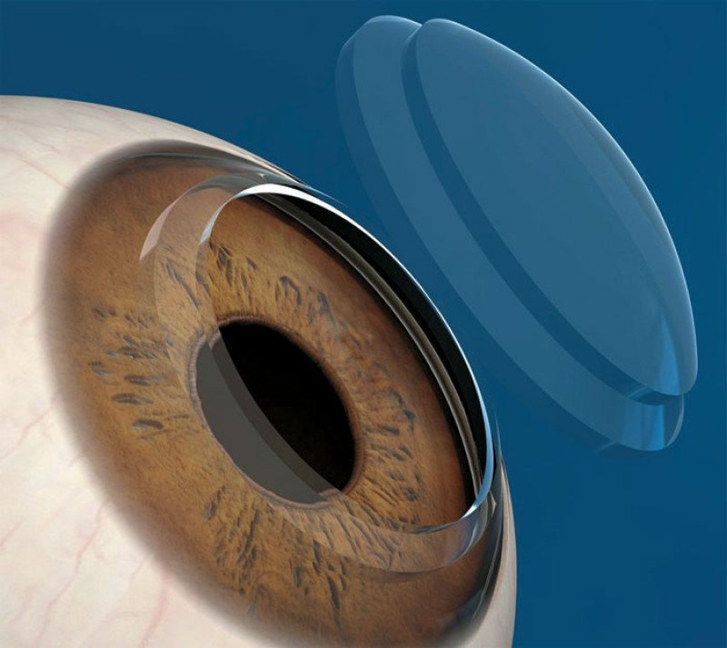 Organizadores. Llaman a todos los oftalmólogos a apoyar al Banco de Córneas y a trabajar en la creación de una cultura de donación.